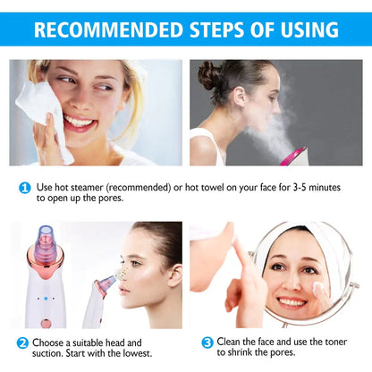 PureSkin™ Pro - Electric Suction Blackhead Remover