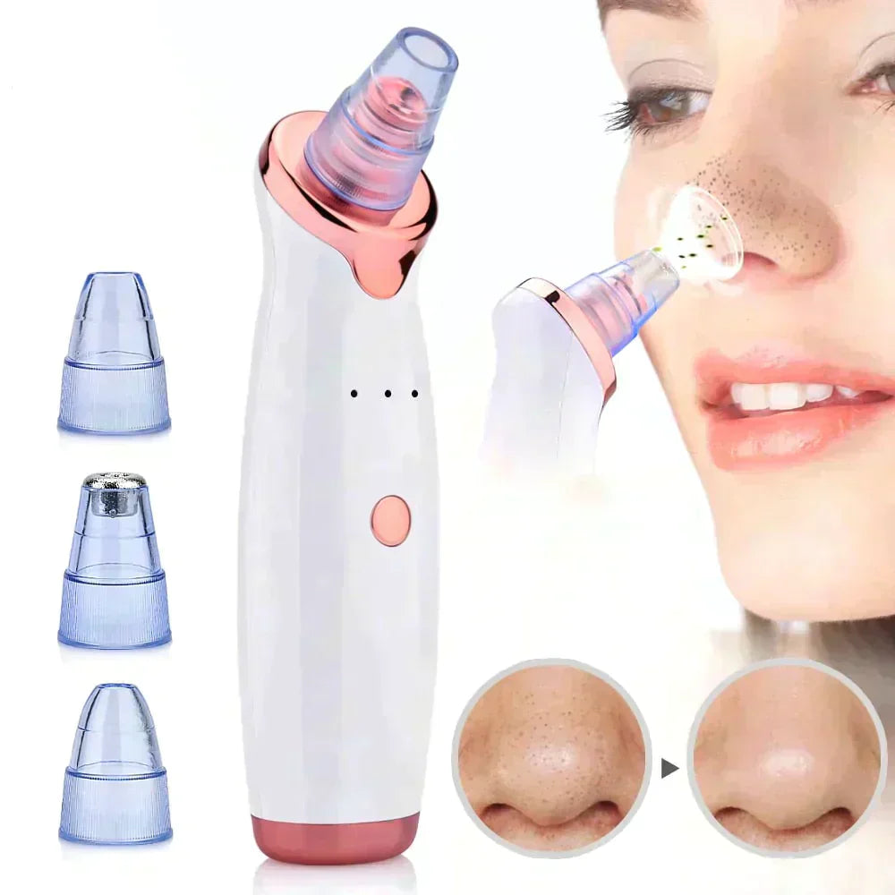 PureSkin™ Pro - Electric Suction Blackhead Remover